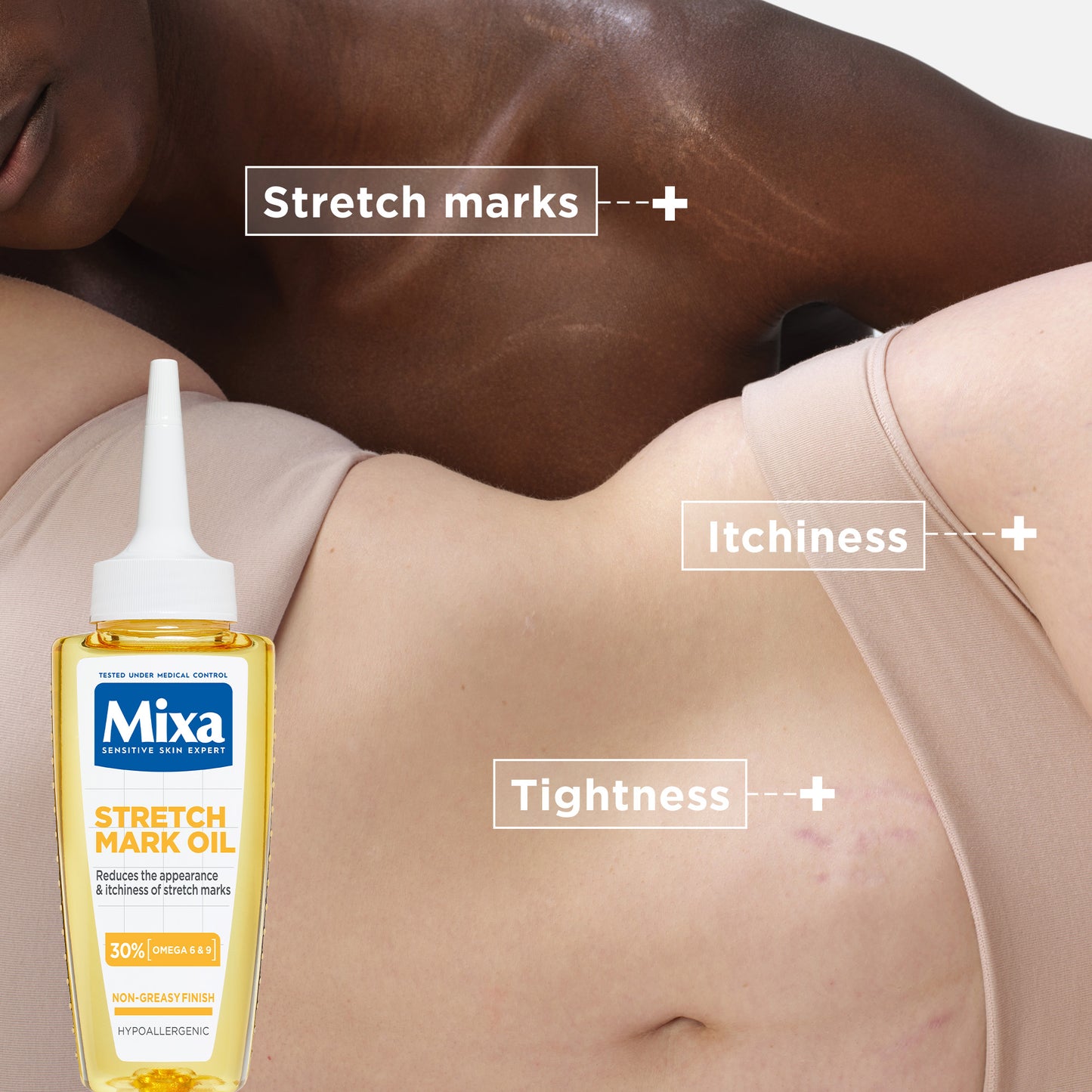 Mixa Stretch Mark Oil 100 ML