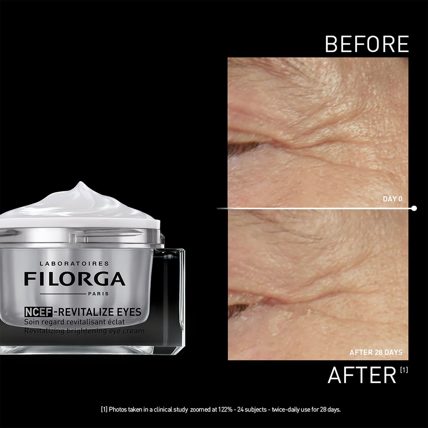 Filorga NCEF-Revitalize Eyes 15 ML